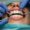 Dental professional applying porcelain veneers during a cosmetic procedure