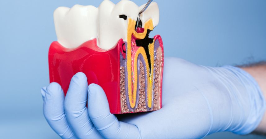 a dentist displaying a 3d model of tooth