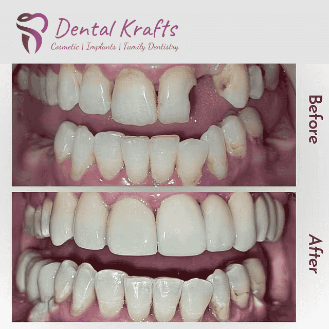 Dental Implants, General Dentist, Family dentistry, Dental Emergency, same day appointment