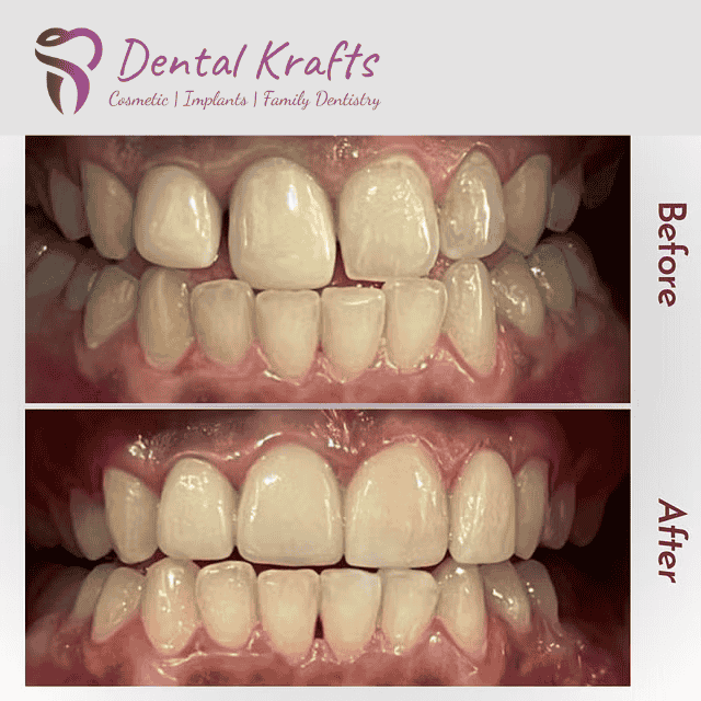 Dental Implants, General Dentist, Family dentistry, Dental Emergency, same day appointment