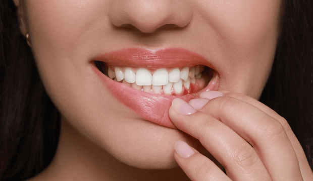 Bleeding Gums