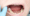 Kid with a mouth cavity