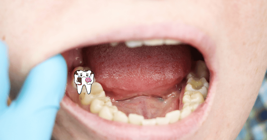 Kid with a mouth cavity