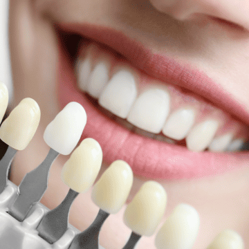 cosmetic dentistry